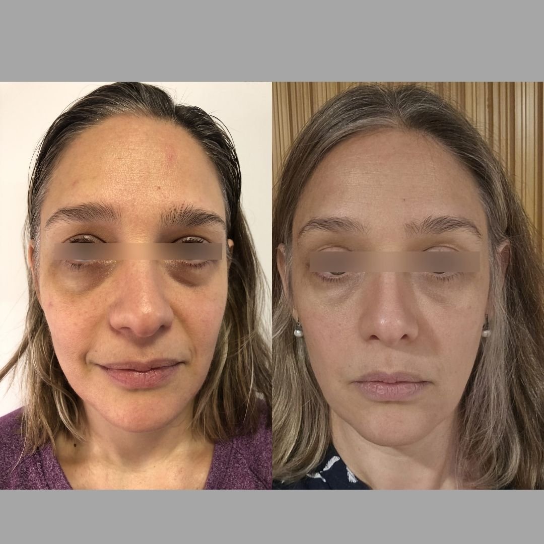 PruebaSocial_Trentini_1